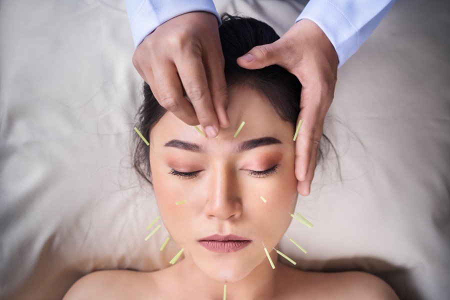 Quels résultats peut-on attendre de l'acupuncture pour maigrir ?