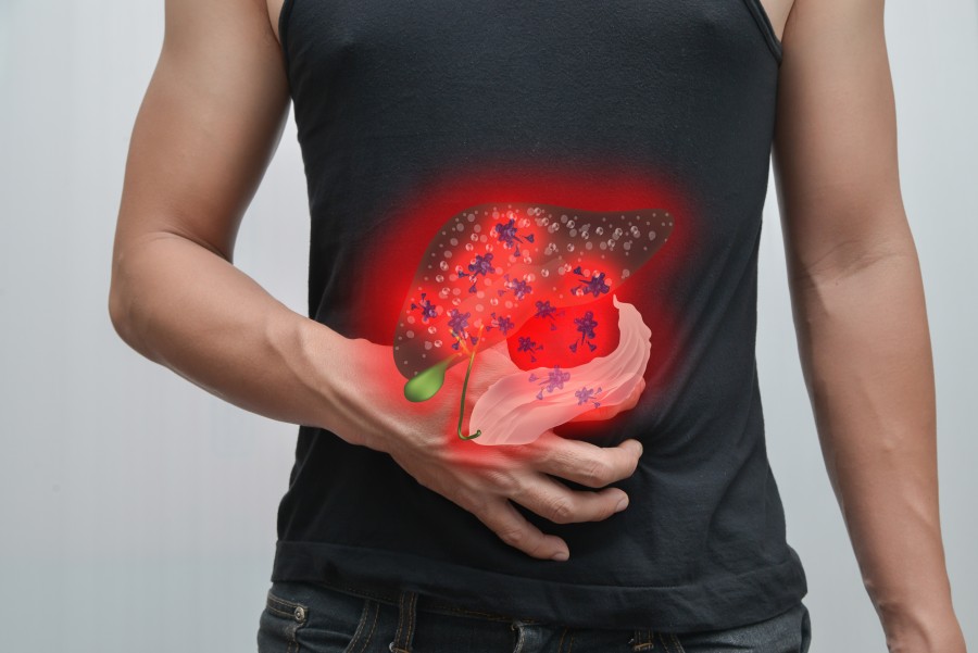 Cancer du pancréas : comment faire face à la maladie ?