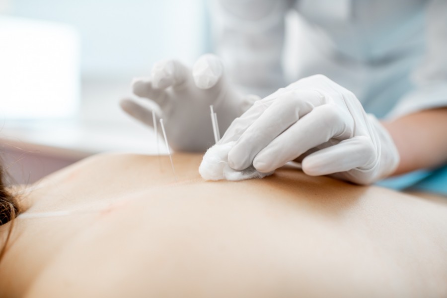 Comment se déroule une séance d'acupuncture pour maigrir ? Comment se déroule une séance d'acupuncture pour maigrir ?