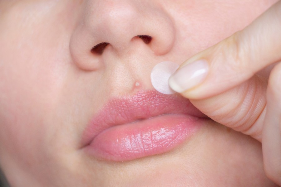 Est-ce-que le bouton de fièvre autour de la bouche est contagieux ?