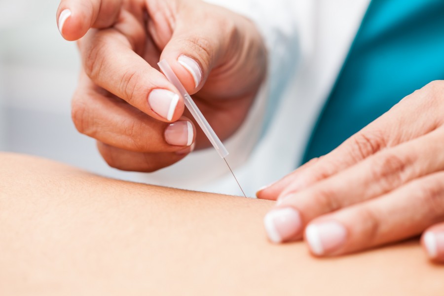 L'acupuncture est-elle une solution efficace pour perdre du poids ? L'acupuncture est-elle une solution efficace pour perdre du poids ?