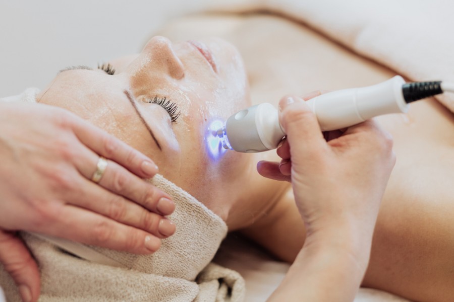 Laser visage : tout ce que vous avez besoin de savoir avant de passer le cap !