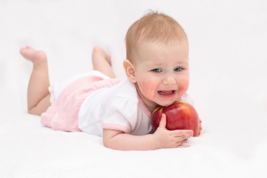 Mycose bébé : comment la traiter ?