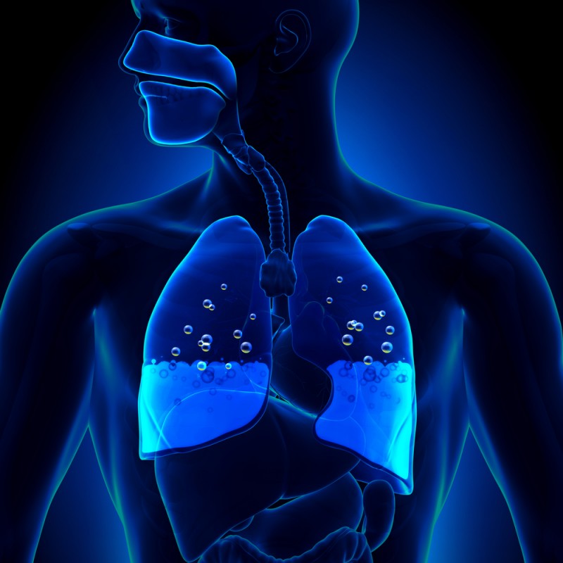 Œdème pulmonaire : tout savoir de ce liquide dans vos poumons