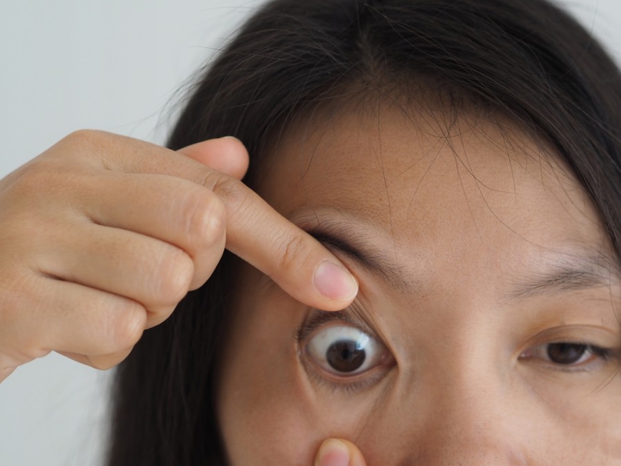 Quels sont les symptômes de la sinusite affectant les yeux ?