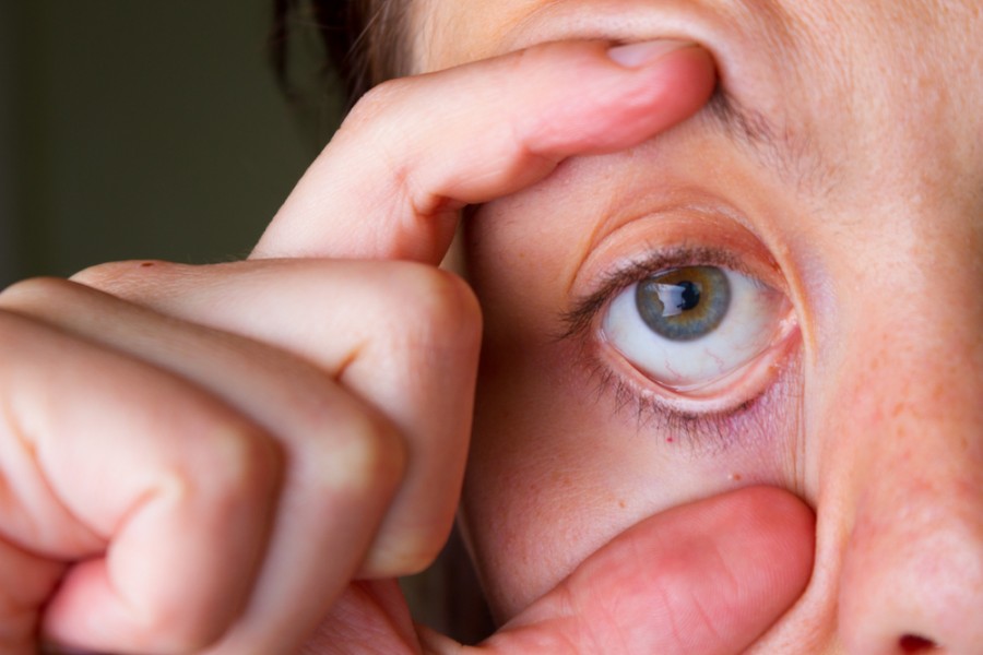 Qu'est-ce que le Cul-de-sac conjonctival de l'œil ?