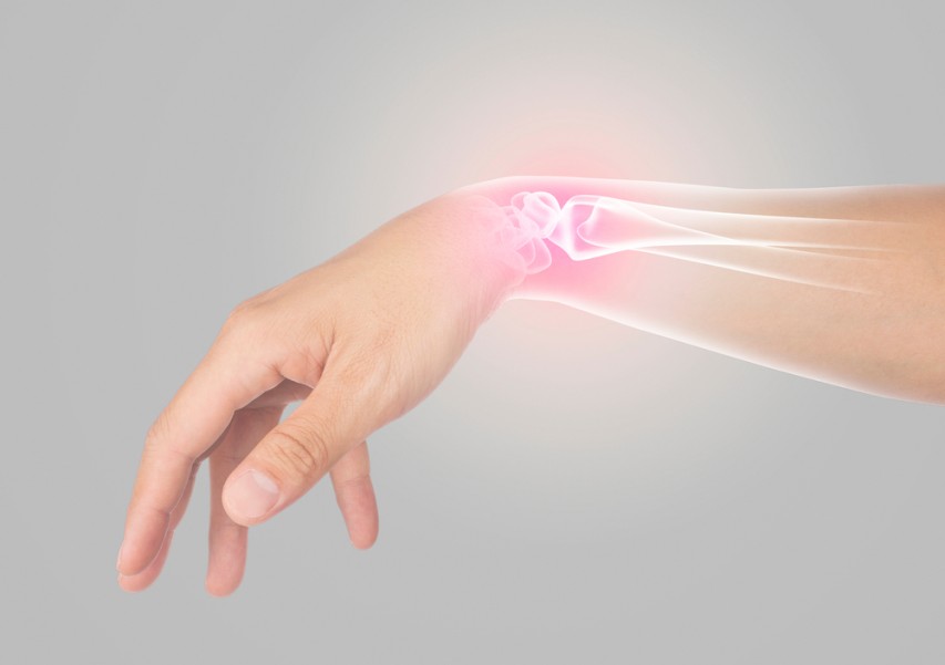 Fracture poignet : comment optimiser la guérison ?